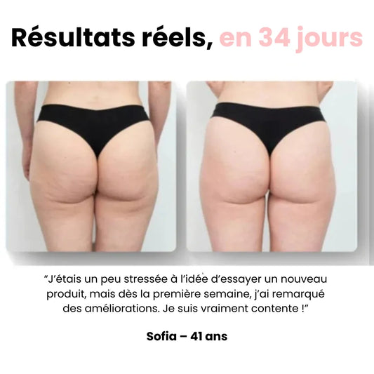 Sôra Sculpt – Masseur Drainant Anti-Cellulite