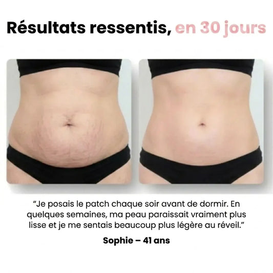 Sôra Shape - Patchs Légèreté & Peau Lisse