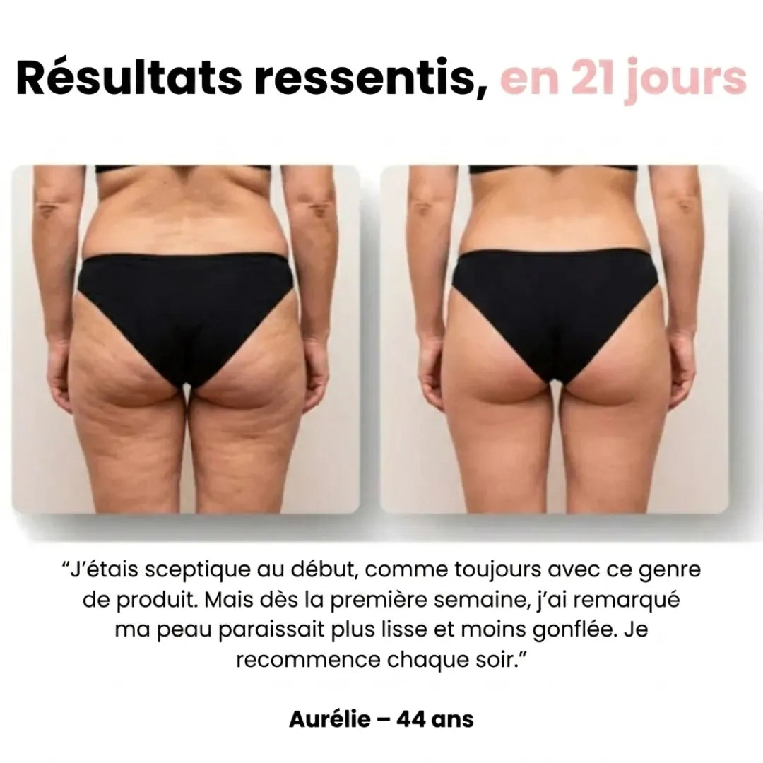 Sôra Shape - Patchs Légèreté & Peau Lisse