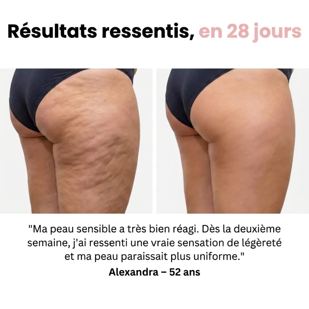 Sôra Shape - Patchs Légèreté & Peau Lisse