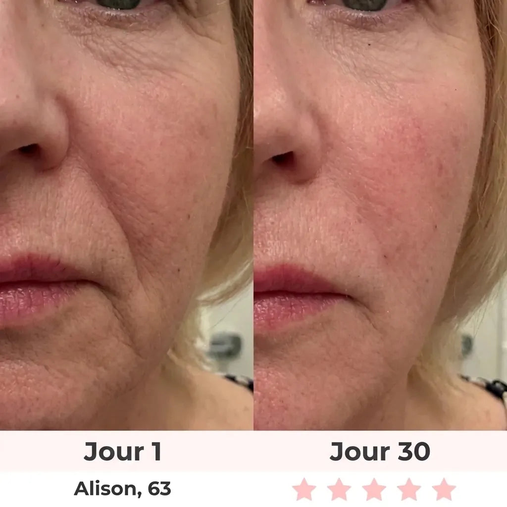 Sculpteur Facial Led 7-en-1 Sôra