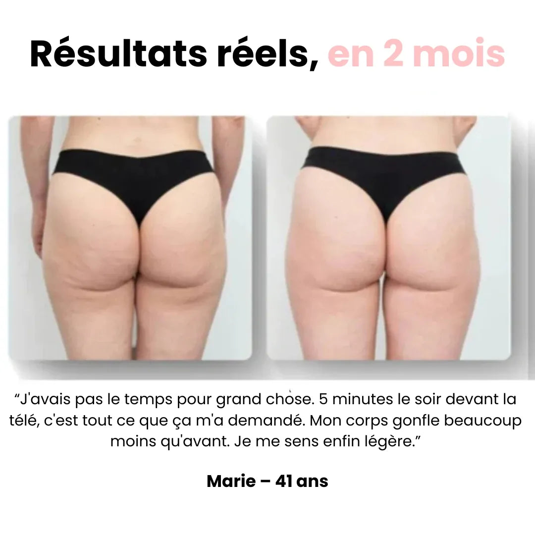 Sôra Vibrasculpt – Masseur Drainant & Raffermissant Anti-Cellulite