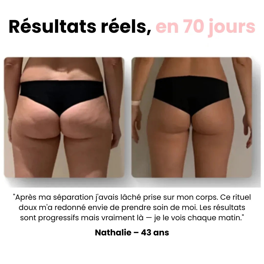 Sôra Vibrasculpt – Masseur Drainant & Raffermissant Anti-Cellulite