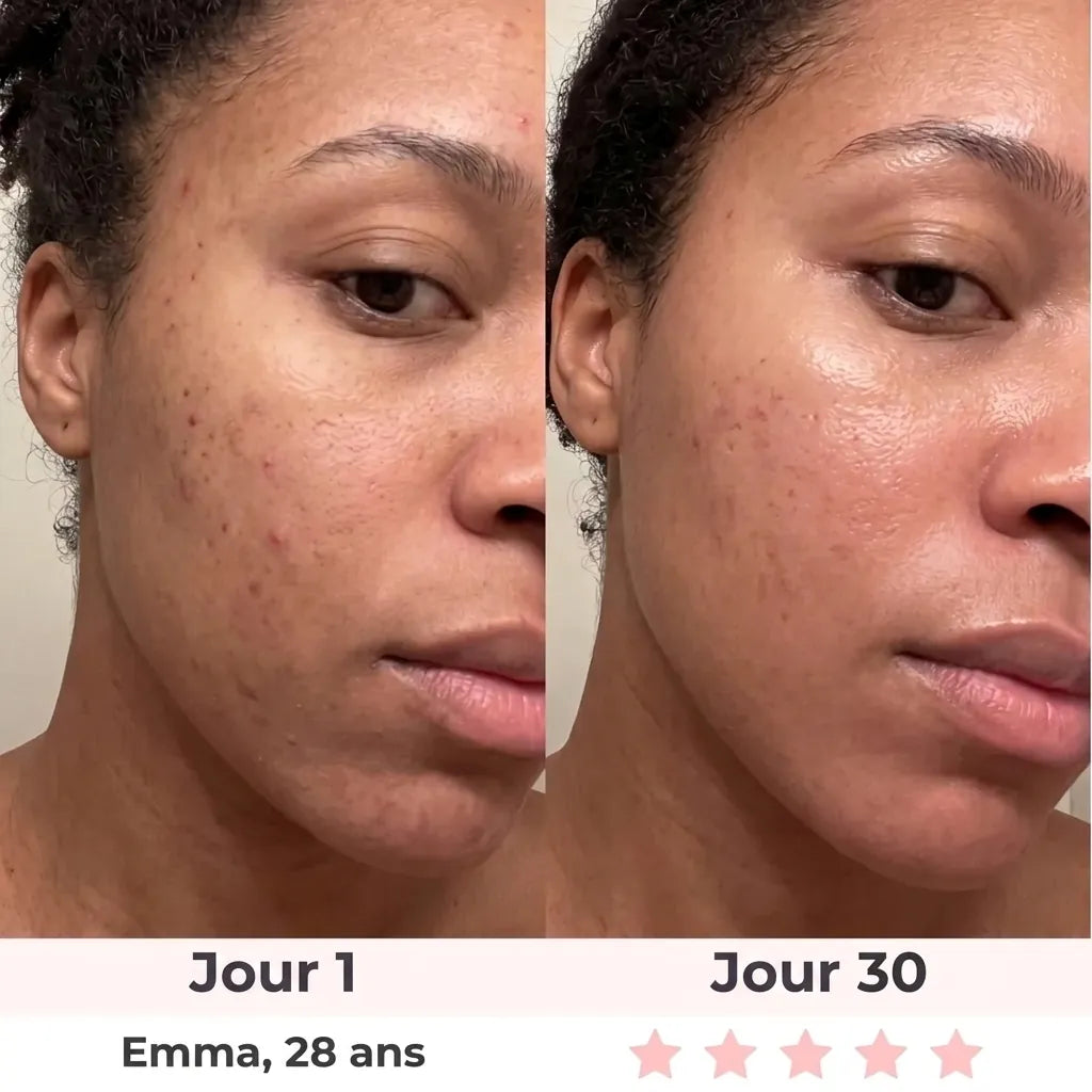 Sérum Visage Raffermissant 5-en-1 à l'Acide Hyaluronique