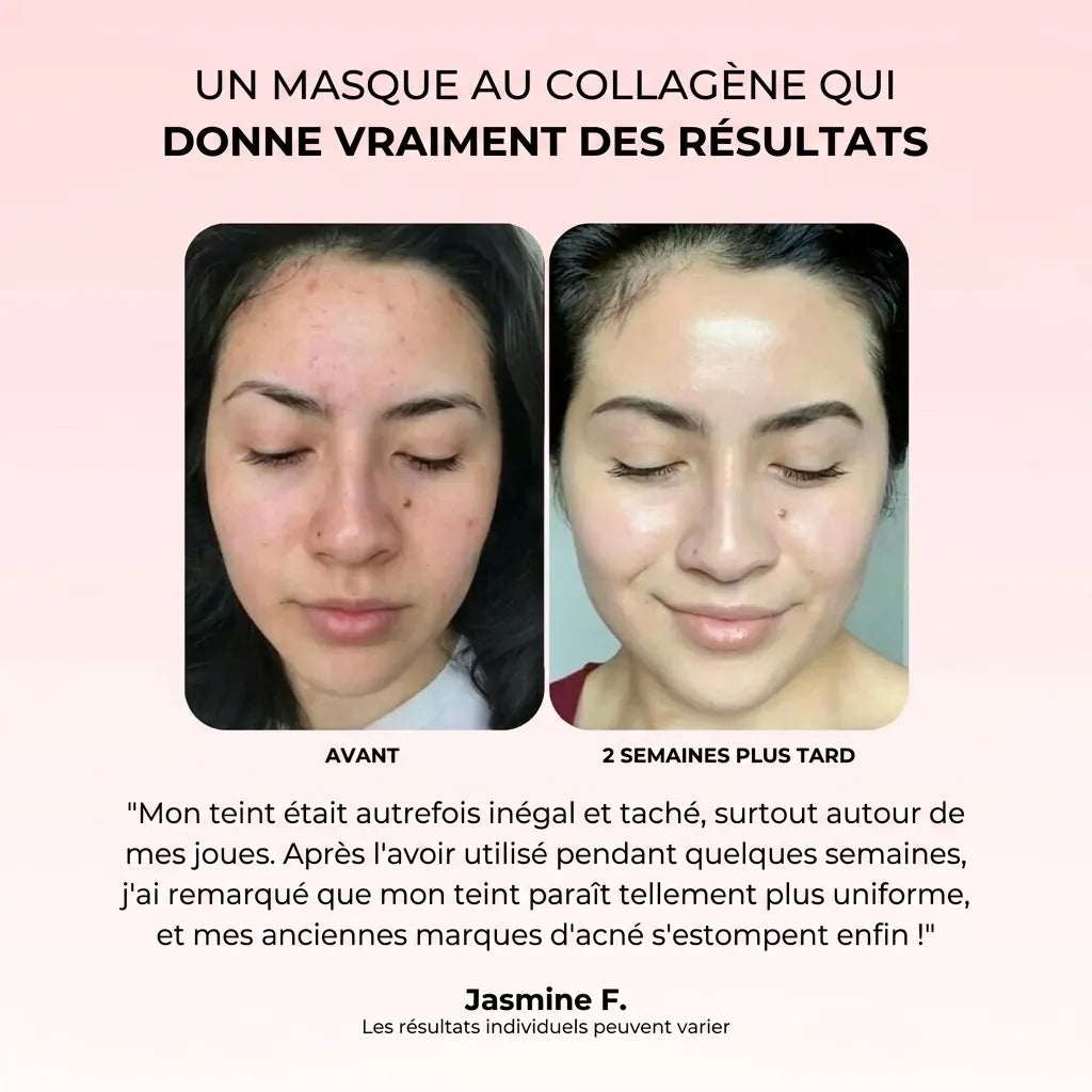 Masque de nuit Collagène et Acide Kojique