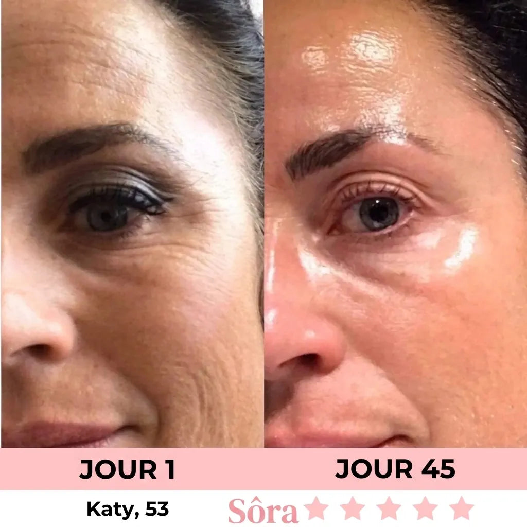 Masque de nuit Collagène et Acide Kojique
