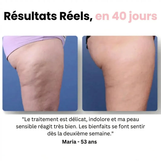 Sôra Sélection - Coffret Anti-Cellulite & Peau Lisse