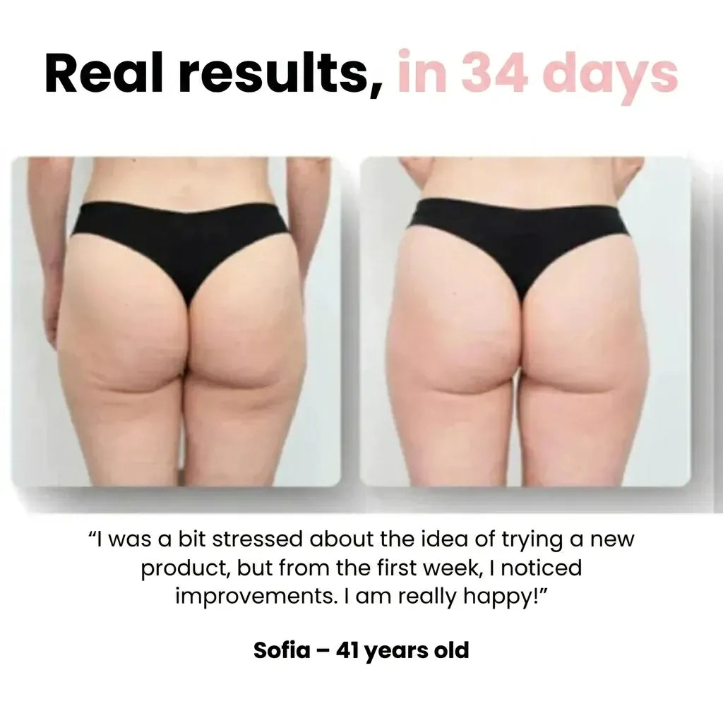 Sôra Boost - Smooth & Sculpted Body in 30 days