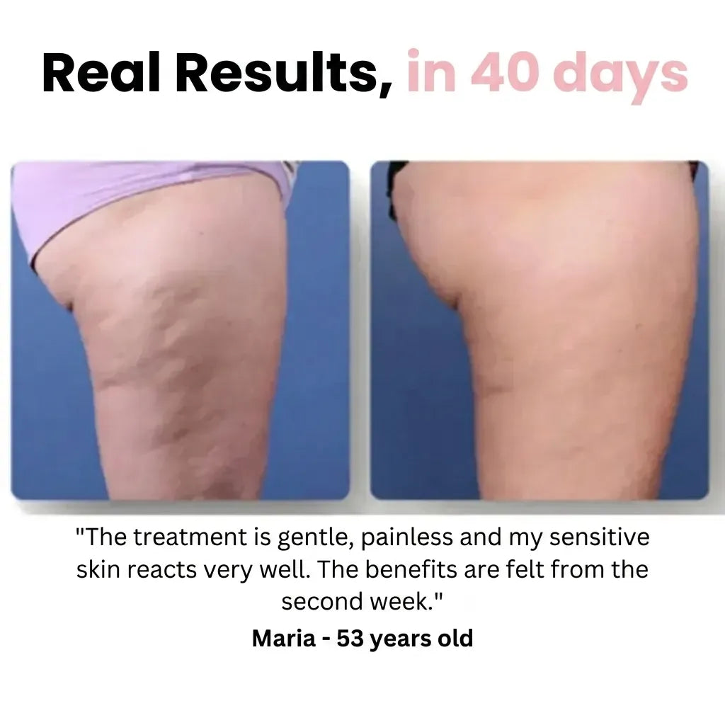 Sôra Boost - Smooth & Sculpted Body in 30 days